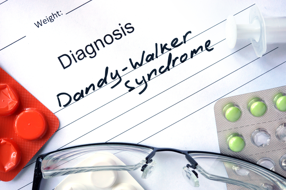 Curso online grátis de Síndrome de Dandy-Walker